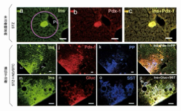 図 未治療STZ糖尿病マウスの肝臓に出現したインスリン陽性細胞(上段)と遺伝子治療による肝臓に出現した膵島(下段)の比較